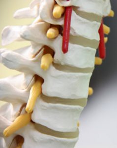 Risks of Minimally Invasive Spine Surgery